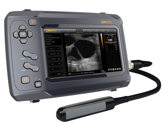 BestScan S6